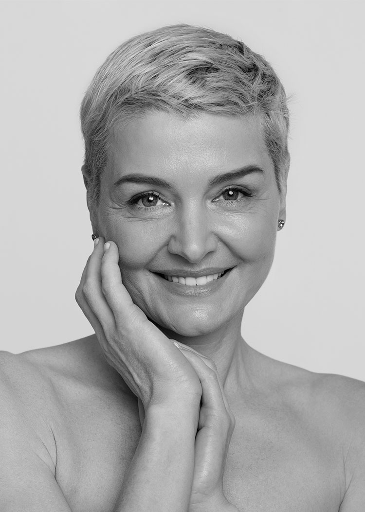 A smiling woman showing brow lift results in Dallas.